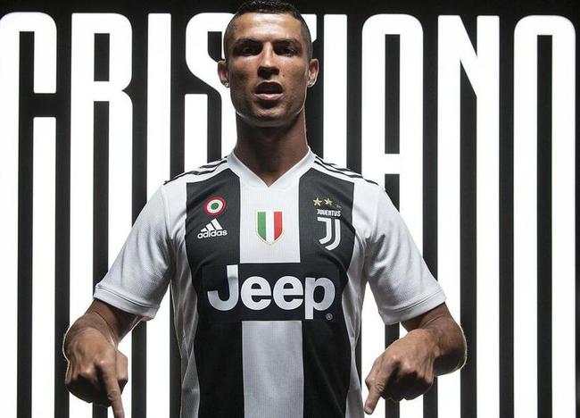 iG名宿秃子多？ rookie ：因为遗传的M型发型已植发